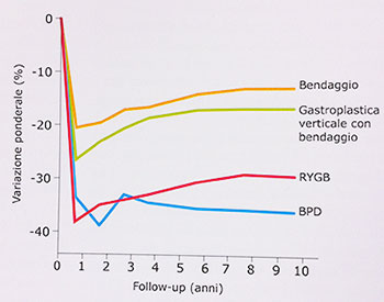 dimagrimento-interventi-chilurgucu
